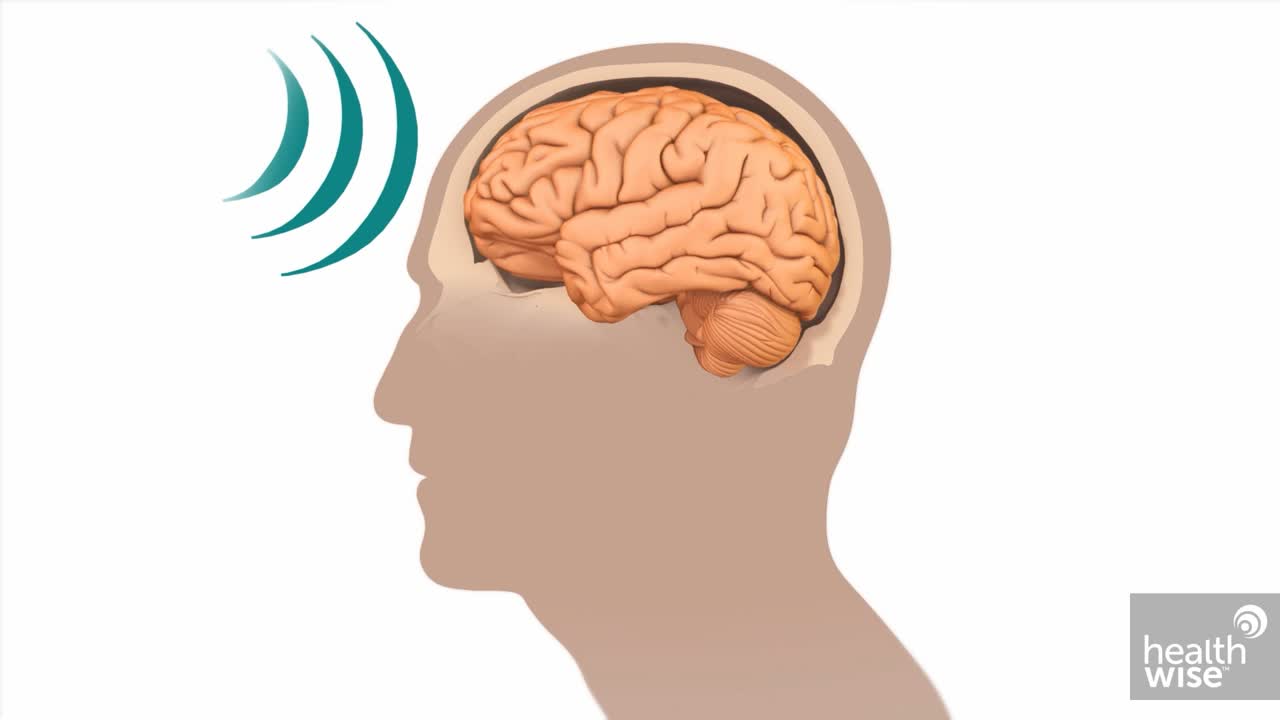 Focus On: Closed Head Injury Video \u0026 Image, image size:1280x720