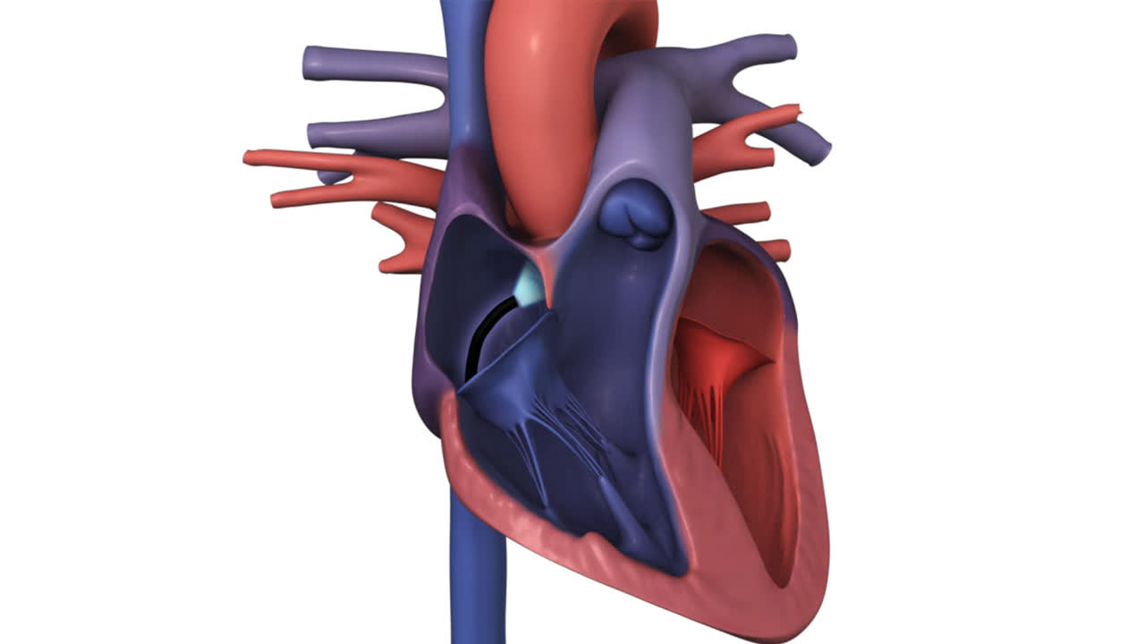 Catheter Ablation for SVT: Before Your Procedure | Kaiser Permanente